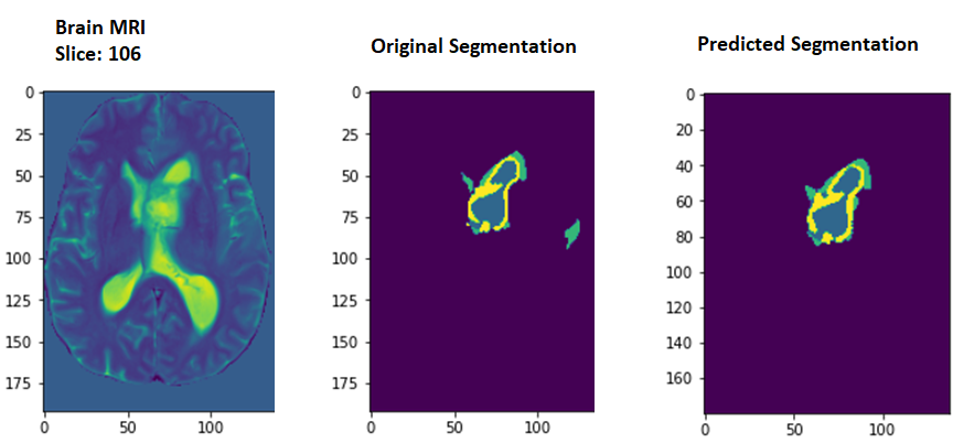 Results obtained from the U-net model